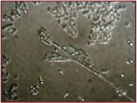 Spores of G. morbida